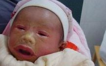 三代试管婴儿私立医院可以吗？有什么风险吗？